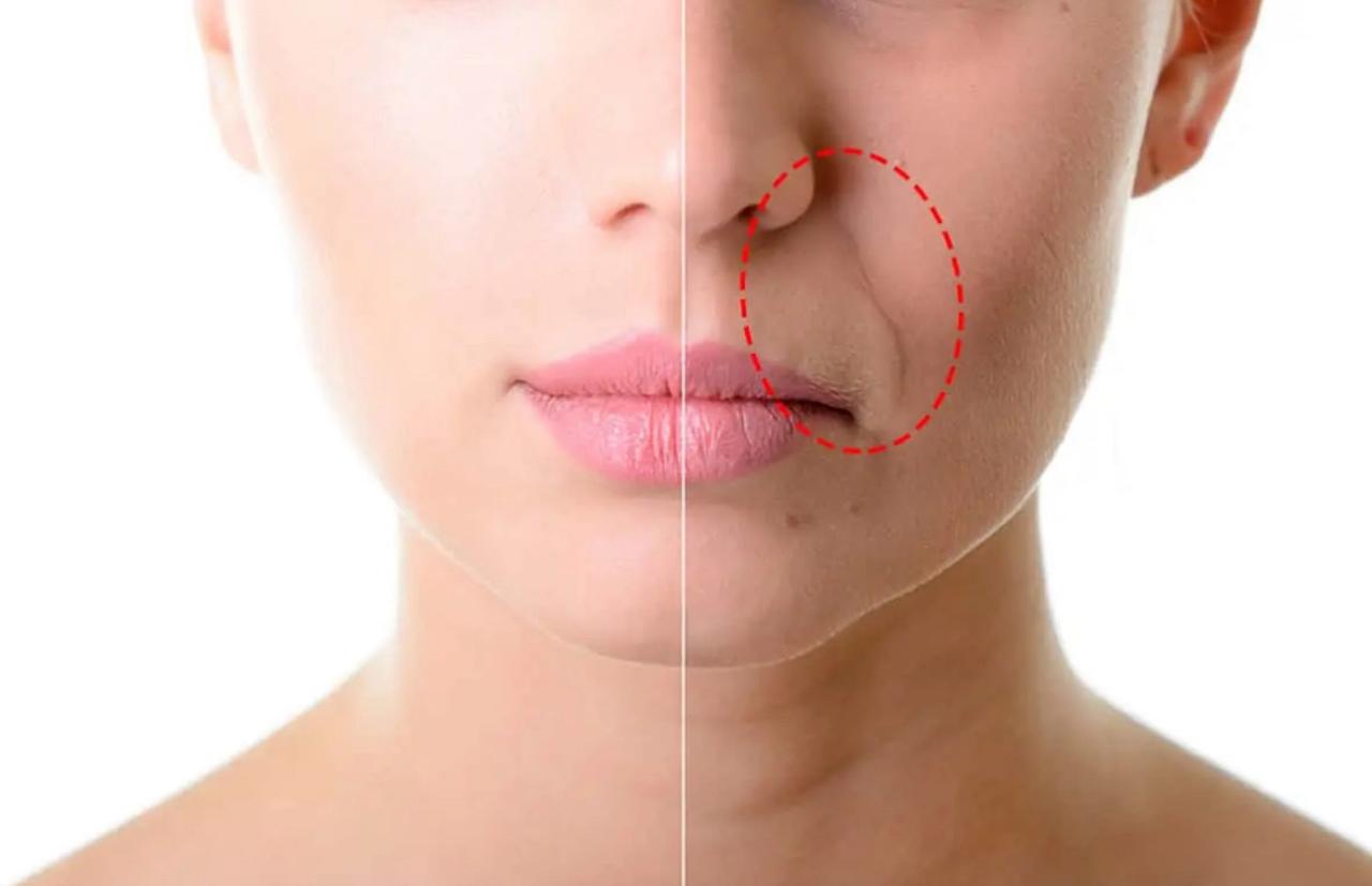 tratamento de Preenchimento de Bigode Chinês